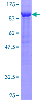 APLP2 Protein - 12.5% SDS-PAGE of human APLP2 stained with Coomassie Blue
