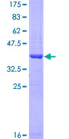 APLP2 Protein - 12.5% SDS-PAGE Stained with Coomassie Blue.
