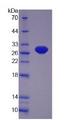APMAP / C20orf3 Protein - Recombinant  Adipocyte Plasma Membrane Associated Protein By SDS-PAGE