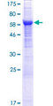 APMAP / C20orf3 Protein - 12.5% SDS-PAGE of human C20orf3 stained with Coomassie Blue