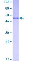APOA1 / Apolipoprotein A 1 Protein - 12.5% SDS-PAGE of human APOA1 stained with Coomassie Blue