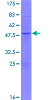 APOA1BP Protein - 12.5% SDS-PAGE of human APOA1BP stained with Coomassie Blue