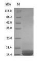 APOB / Apolipoprotein B Protein - (Tris-Glycine gel) Discontinuous SDS-PAGE (reduced) with 5% enrichment gel and 15% separation gel.