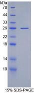 APOB / Apolipoprotein B Protein - Recombinant Apolipoprotein B100 (APOB100) by SDS-PAGE