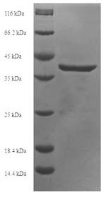 APOBEC3A Protein - (Tris-Glycine gel) Discontinuous SDS-PAGE (reduced) with 5% enrichment gel and 15% separation gel.