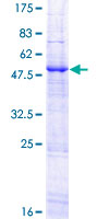 APOBEC3B Protein - 12.5% SDS-PAGE of human APOBEC3B stained with Coomassie Blue