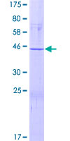 APOBEC3C Protein - 12.5% SDS-PAGE of human APOBEC3C stained with Coomassie Blue