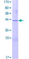 APOBEC3C Protein - 12.5% SDS-PAGE of human APOBEC3C stained with Coomassie Blue
