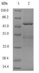 APOBEC3C Protein - (Tris-Glycine gel) Discontinuous SDS-PAGE (reduced) with 5% enrichment gel and 15% separation gel.