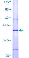 APOBEC3C Protein - 12.5% SDS-PAGE Stained with Coomassie Blue