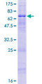 APOBEC3D Protein - 12.5% SDS-PAGE of human APOBEC3D stained with Coomassie Blue