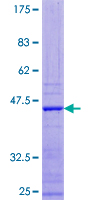 APOBEC3F / ARP8 Protein - 12.5% SDS-PAGE of human APOBEC3F stained with Coomassie Blue