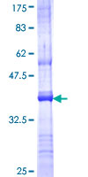 APOBEC3F / ARP8 Protein - 12.5% SDS-PAGE Stained with Coomassie Blue.