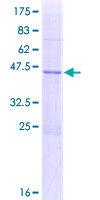 APOBEC3H Protein - 12.5% SDS-PAGE of human APOBEC3H stained with Coomassie Blue