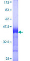 APOBR / APOB48R Protein - 12.5% SDS-PAGE Stained with Coomassie Blue.