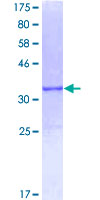 APOC2 / Apolipoprotein C II Protein - 12.5% SDS-PAGE of human APOC2 stained with Coomassie Blue