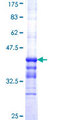APOC2 / Apolipoprotein C II Protein - 12.5% SDS-PAGE Stained with Coomassie Blue.