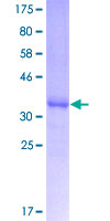 APOC3 / Apolipoprotein C III Protein - 12.5% SDS-PAGE Stained with Coomassie Blue.