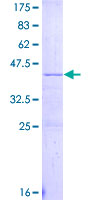 APOC4 / Apolipoprotein CIV Protein - 12.5% SDS-PAGE of human APOC4 stained with Coomassie Blue
