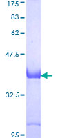 APOER2 / LRP8 Protein - 12.5% SDS-PAGE Stained with Coomassie Blue.