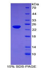 APOF / Apolipoprotein F Protein - Recombinant Apolipoprotein F By SDS-PAGE