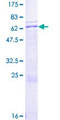 APOH / Apolipoprotein H Protein - 12.5% SDS-PAGE of human APOH stained with Coomassie Blue