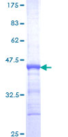 APOH / Apolipoprotein H Protein - 12.5% SDS-PAGE Stained with Coomassie Blue.