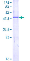 APOL1 / Apolipoprotein L Protein - 12.5% SDS-PAGE of human APOL1 stained with Coomassie Blue