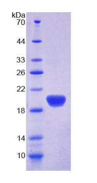 APOL2 / Apolipoprotein L 2 Protein - Recombinant  Apolipoprotein L2 By SDS-PAGE