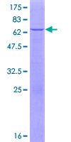 APOL6 / Apolipoprotein L 6 Protein - 12.5% SDS-PAGE of human APOL6 stained with Coomassie Blue