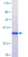 APOL6 / Apolipoprotein L 6 Protein - 12.5% SDS-PAGE Stained with Coomassie Blue.
