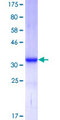 Apolipoprotein A-II Protein - 12.5% SDS-PAGE of human APOA2 stained with Coomassie Blue