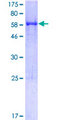 Apolipoprotein A-V Protein - 12.5% SDS-PAGE of human APOA5 stained with Coomassie Blue