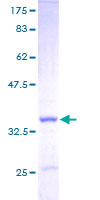 Apolipoprotein C-I Protein - 12.5% SDS-PAGE of human APOC1 stained with Coomassie Blue