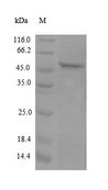 APOM / Apolipoprotein M Protein - (Tris-Glycine gel) Discontinuous SDS-PAGE (reduced) with 5% enrichment gel and 15% separation gel.