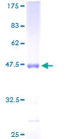 APOM / Apolipoprotein M Protein - 12.5% SDS-PAGE of human APOM stained with Coomassie Blue