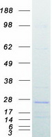 APOO / Apolipoprotein O Protein - Purified recombinant protein APOO was analyzed by SDS-PAGE gel and Coomassie Blue Staining