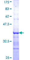 Apoptosis related protein (APR-2) Protein - 12.5% SDS-PAGE Stained with Coomassie Blue