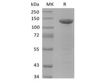 APP / Beta Amyloid Precursor Protein - Recombinant Human Amyloid Precursor (C-FC)