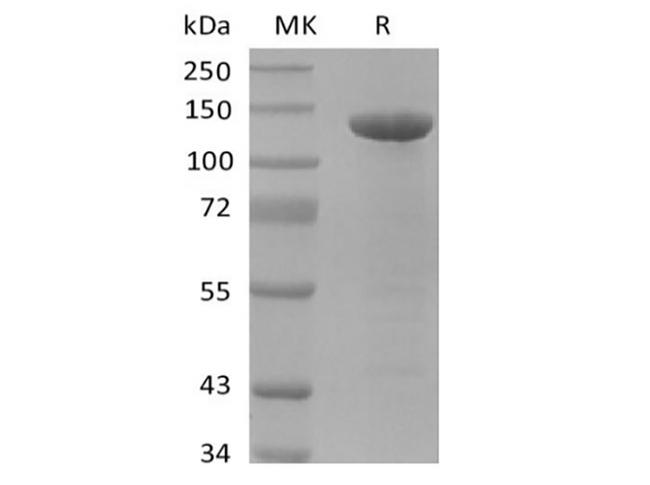 APP / Beta Amyloid Precursor Protein - Recombinant Human Amyloid Precursor (C-FC)