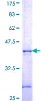 APPBP2 Protein - 12.5% SDS-PAGE Stained with Coomassie Blue.