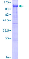 APPL1 / APPL Protein - 12.5% SDS-PAGE of human APPL1 stained with Coomassie Blue