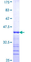 APPL1 / APPL Protein - 12.5% SDS-PAGE Stained with Coomassie Blue.