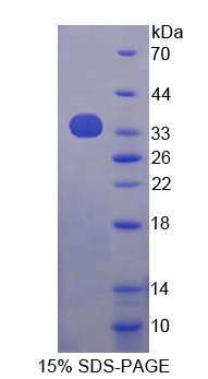 APPL1 / APPL Protein - Recombinant  Adaptor Protein Phosphotyrosine Interaction PH Domain And leucine Zipper Containing Protein 1 By SDS-PAGE