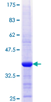 APPL2 Protein - 12.5% SDS-PAGE Stained with Coomassie Blue.