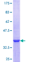 Aprataxin / APTX Protein - 12.5% SDS-PAGE Stained with Coomassie Blue.