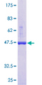 APRT Protein - 12.5% SDS-PAGE of human APRT stained with Coomassie Blue