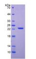 APRT Protein - Active Adenine Phosphoribosyltransferase (APRT) by SDS-PAGE