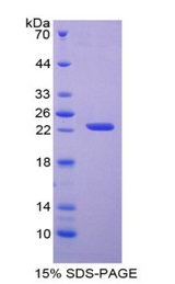 APRT Protein - Recombinant Adenine Phosphoribosyltransferase By SDS-PAGE