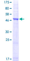 AQP1 / Aquaporin 1 Protein - 12.5% SDS-PAGE of human AQP1 stained with Coomassie Blue